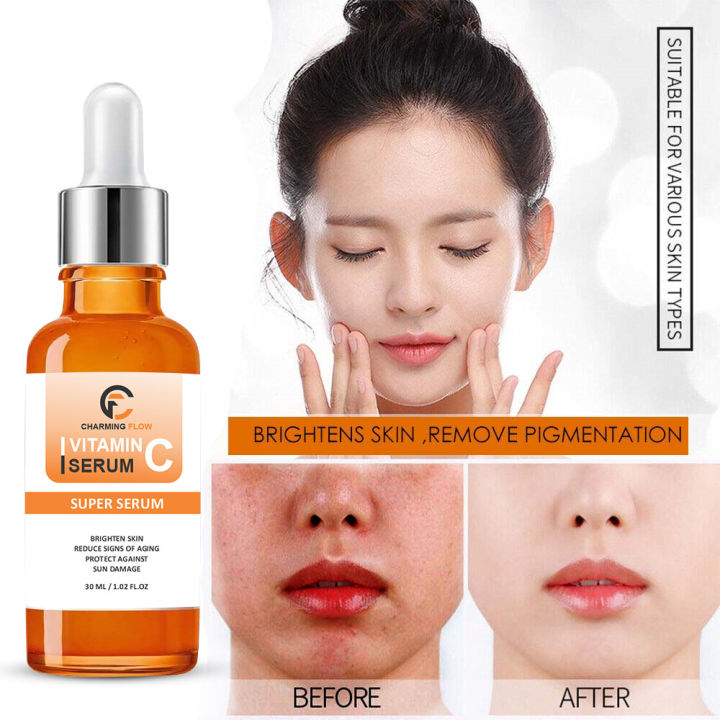 CHARMING FLOW Vitamin C Brightening Serum for Face – Anti Aging Face Serum – Brightening Serum for Dark Spots, Even Skin Tone, Eye Area, Fine Lines & Wrinkles for all skin types 30 ml