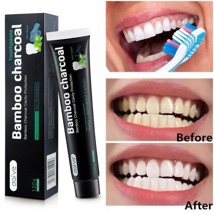 charcol%20teeth%20whitening%20toothpaste%20-%20Image%204