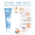 Scar Remover Cream Fade Acne Spots Section Scars Stretch Marks Burn Surgical Treatment Repair Smoothing Whitening Gel Skin Care. 