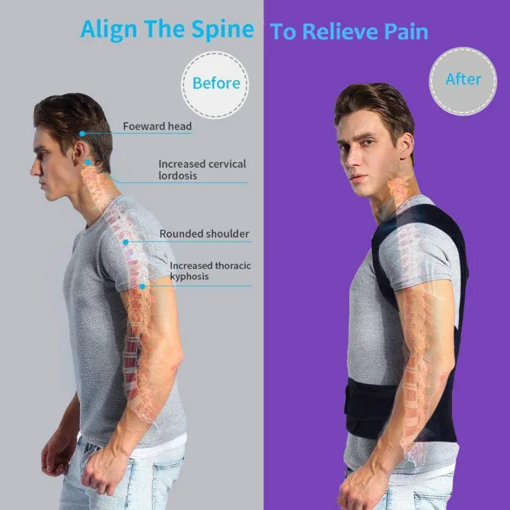 Back%20Brace%20Posture%20Corrector,Back%20Straightener%20Posture%20Corrector%20for%20Women,Unisex%20Back%20Support,Correct%20Back%20Posture%20Corrector%20for%20Pain%20Relief,%20Adjustable%20Magnetic%20Posture%20Belts%20for%20Men%20and%20Women%20Upper%20Back%20-%20Image%202