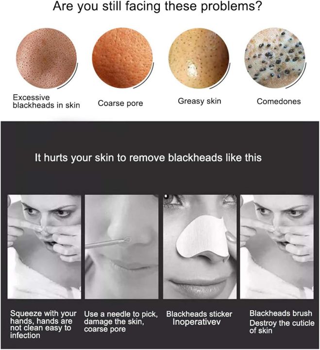 SP%20Dealz%205%20in%201%20Blackhead%20Remover%20Electric%20Blackhead%20Suction%20Device%20LCD%20Display%20with%205%20Pimple%20Zit%20Comedone%20Extractor%20Tool%20Acne%20Removal%20Kit%20with%205%20Probes%20for%20Household%20Face%20Pore%20Cleaner%20-%20Image%204