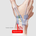 Breathable Thumb Splint Medical-Grade Anti-Slip Elastic Wrist Support Adjustable Wrist Brace for Sports Injury Recovery. 