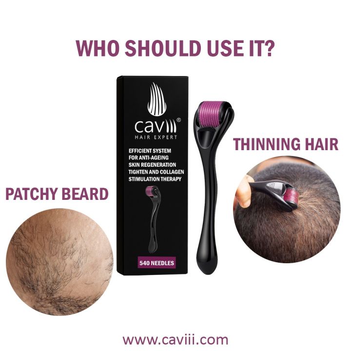Caviii%20Derma%20Roller%20Premium%20quality%20Imported%20HIgh%20quality%20Different%20sized%200.5mm%200.75mm%201mm%201.5mm%20-%20Image%205