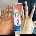 Kojic Skin Whitening Hand Foot Cream - Moisturizing & Brightening with Hyaluronic Acid, Glycerin & Vitamin E for Normal Skin, Rapid Tone Lightening for Dark Spots On Hands, Arms Feet Safe and Effective. 