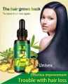 7 Day Ginger Oil Natural Hair Loss Treatement Effective Fast Growth Hair Care 30ML. 
