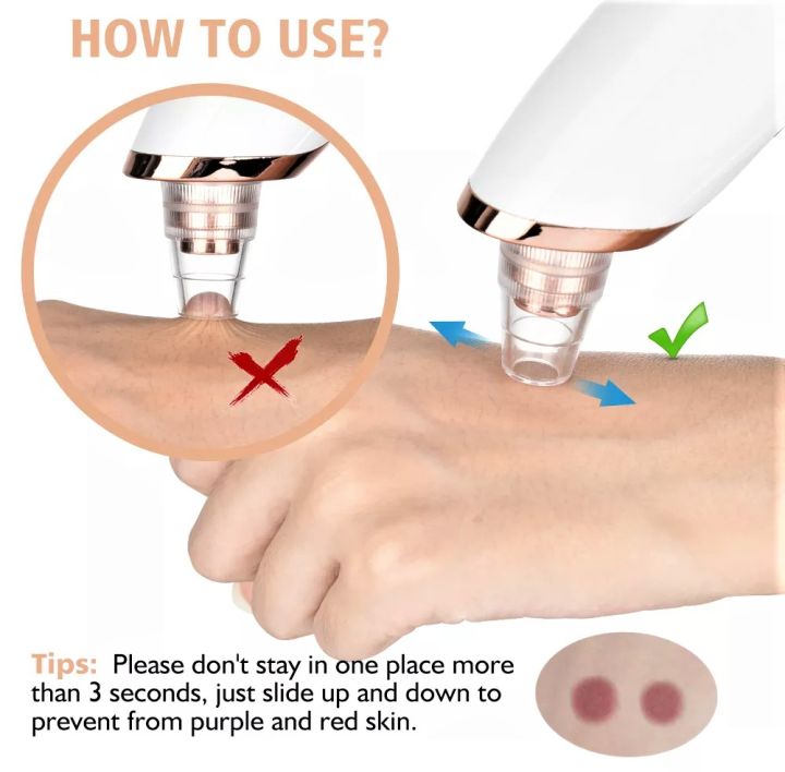 Derma%20Suction%20%7C%205%20in%201%20Multifunction%20Blackhead%20Removal%20Rechargeable%20Machine%20%7C%20White%20Head%20Vacuum%20Suction%20Face%20Pore%20Cleaner%20Nose%20Sucking%20Extractor%20%7C%20Blackheads%20Removal%20Device%20Derma%20Suction%20Chargeable%20-%20Image%205