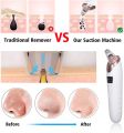 SP Dealz 5 in 1 Blackhead Remover Electric Blackhead Suction Device LCD Display with 5 Pimple Zit Comedone Extractor Tool Acne Removal Kit with 5 Probes for Household Face Pore Cleaner. 