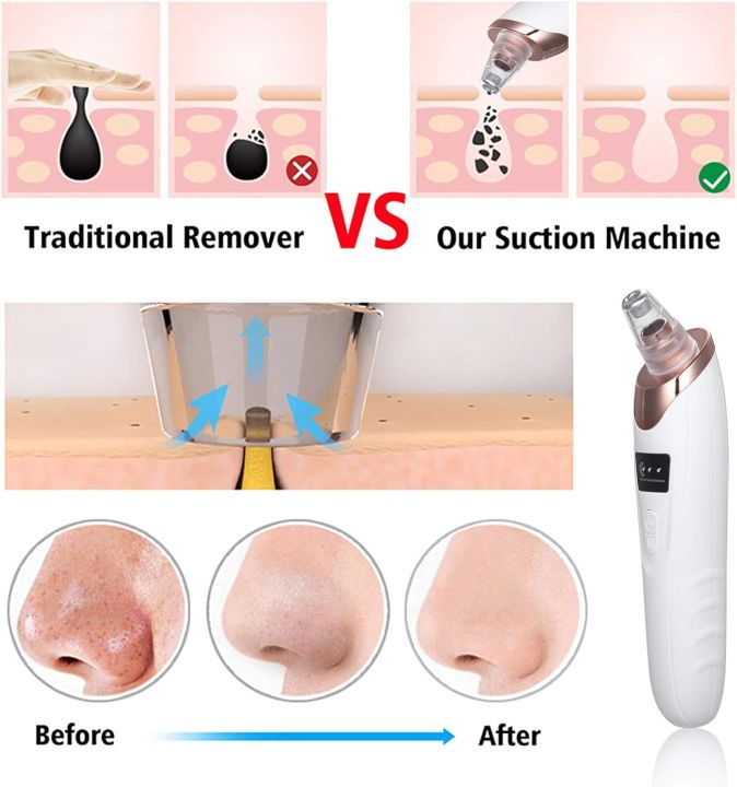 SP%20Dealz%205%20in%201%20Blackhead%20Remover%20Electric%20Blackhead%20Suction%20Device%20LCD%20Display%20with%205%20Pimple%20Zit%20Comedone%20Extractor%20Tool%20Acne%20Removal%20Kit%20with%205%20Probes%20for%20Household%20Face%20Pore%20Cleaner%20-%20Image%208