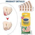 Royal Prestige Ingrown Toenail Pain Reliever | 30 Protective Patches | Fast Relief from Ingrown Toenail Discomfort | Anti‑Inflammatory & Cushion Support | Easy Application | Safe, Hygienic Foot Care Solution. 