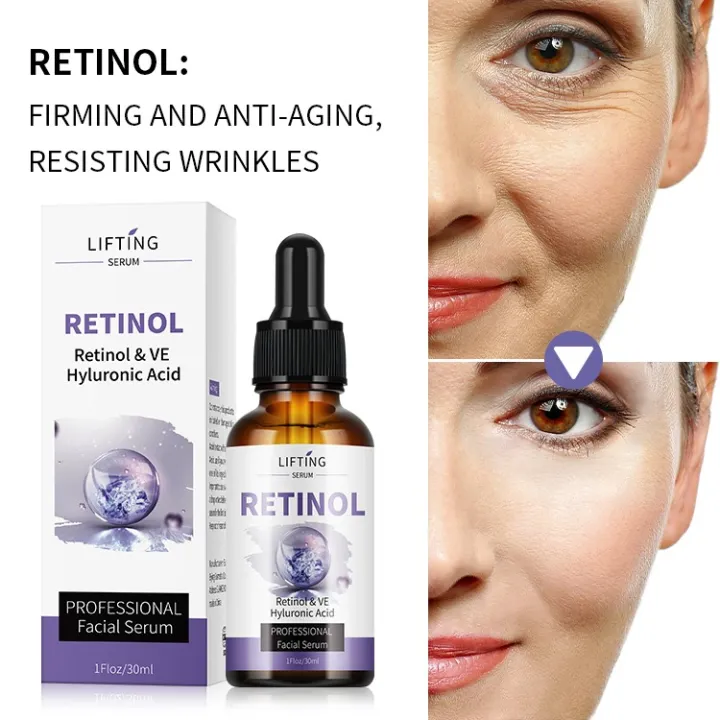 Pack%20Of%202%20Retinol%20Face%20Serum%20%7C%20Anti%20Aging%20Serum%20with%20Hyaluronic%20Acid%20&%20Vitamin%20E%20%7C%20Open%20Pores%20Minimizer%20%7C%20Oil%20Control%20for%20Oily%20Skin%20%7C%20Hydrating%20&%20Moisturizing%20%7C%20Dark%20Spots,%20Acne%20Marks%20&%20Wrinkle%20Repair%20Serum%20-%20Image%205