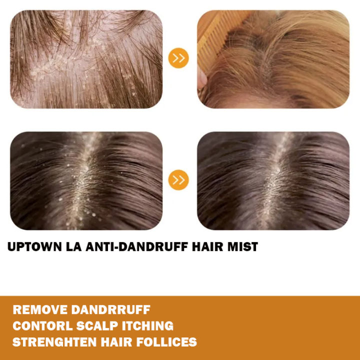 UPTOWN%20LA%20Anti%20Dandruff%20Hair%20Mist%20For%20Dandruff%20Removal%20and%20Itching%20Control%20For%20all%20Hair%20types%20-%20Image%202