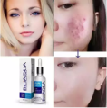 New ACNE & PIMPLES REMOVAL CREAM, Acne Scar Mark Remover Removal Oil Control Shrink Pores Treatments Cream. 
