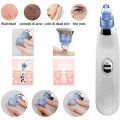 DermaSuction Vacuum Pore Cleaning Device With 4 Interchangeable Suction Heads. 
