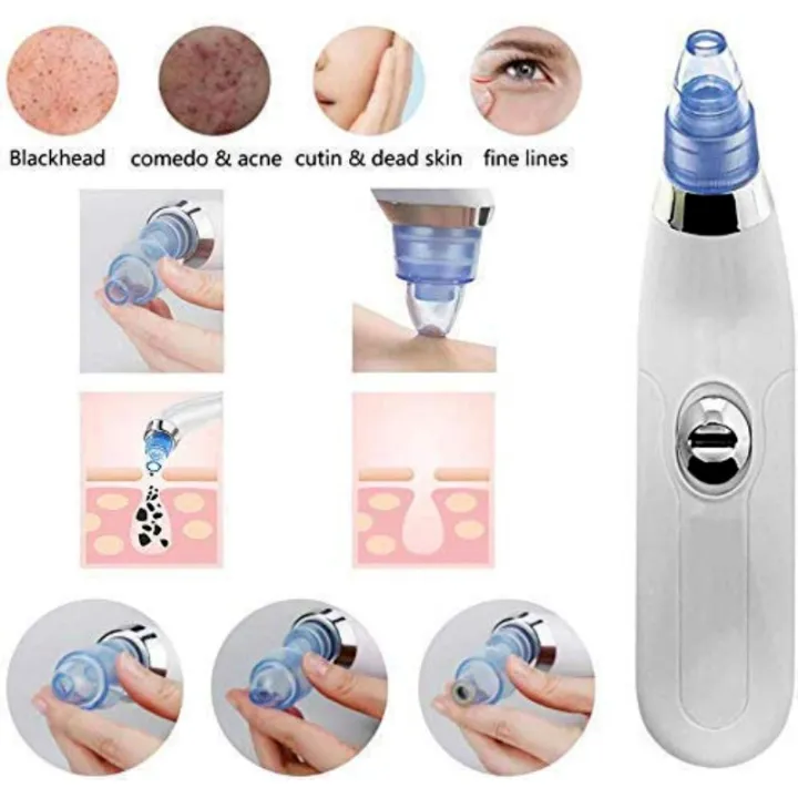 Derma%20Suction%20Vacuum%20Pore%20Cleaning%20Device%20With%204%20Interchangeable%20Suction%20Heads%20-%20Image%205
