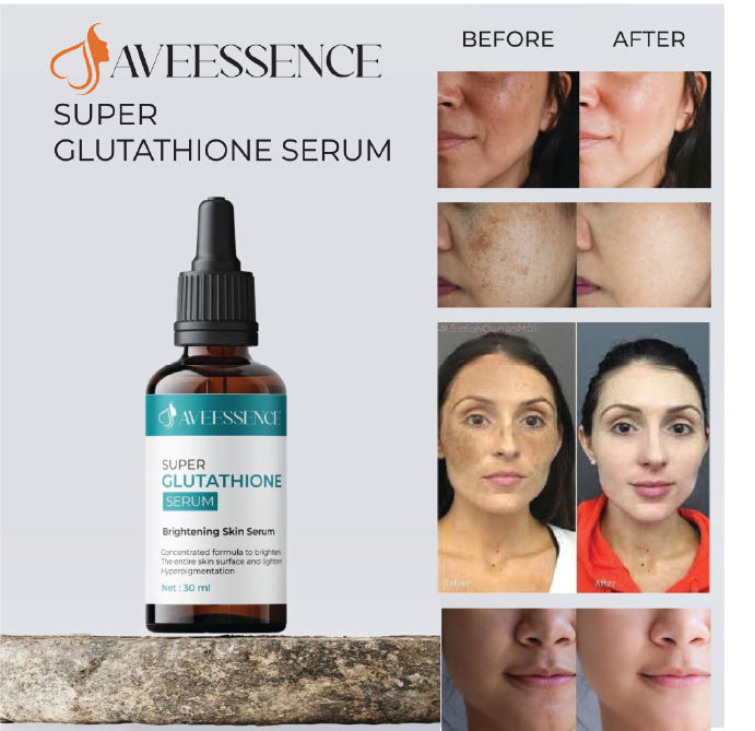 AVEESSENCE Super Glutathione Brightening Serum Skin Glow, Hyperpigmentation & Dark Spot Corrector 30ml