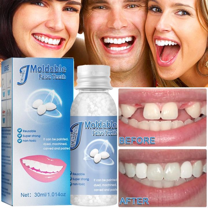 Moldable%20Temporary%20Repairing%20Kit%20Resin%20Dentist%20False%20Teeth%20Gaps%20Solid%20Glue%20Denture%20Adhesive%20Tooth%20Whitening%20Beauty%20Tools%20-%20Image%202