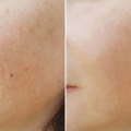 Face Fresh L-Glutathione Ampule (5ml). 