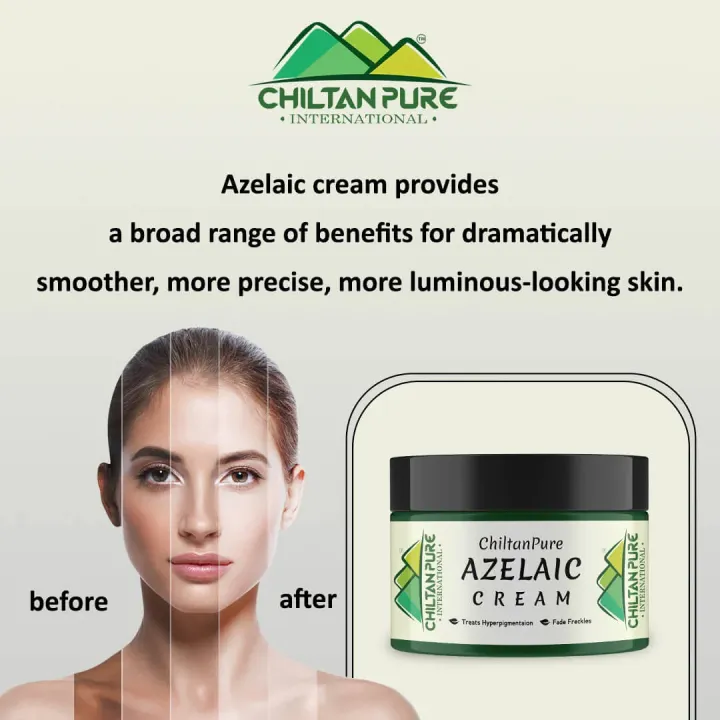 Azelaic%20Cream%20%E2%80%93%20Antibacterial,%20Reduce%20Hyperpigmentation%20&%20Fade%20Acne%20Scars%20-%20Image%204