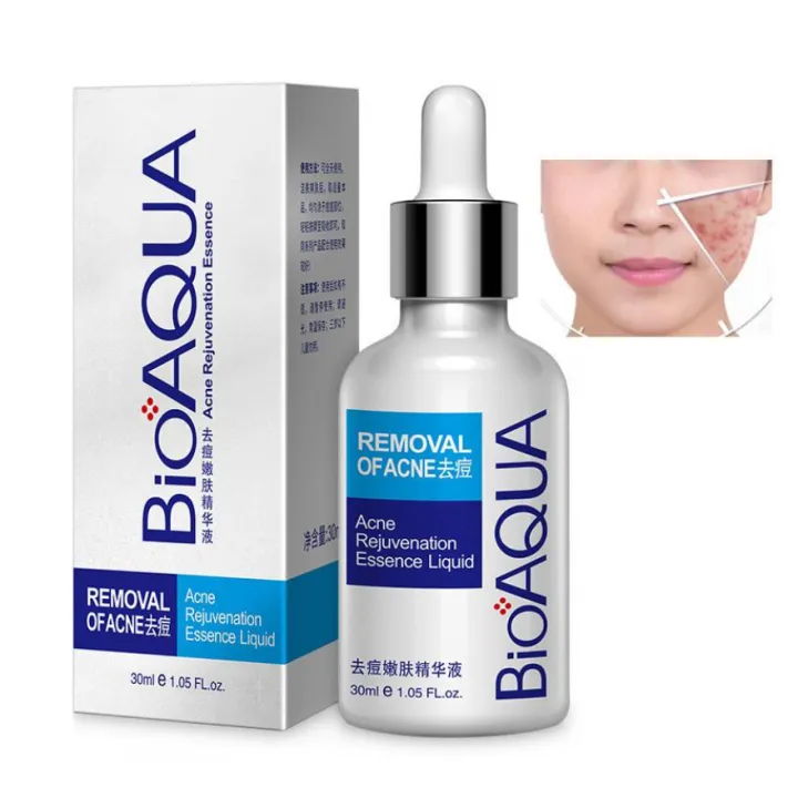 BIOAQUA%20Acne%20Removal%20&%20Acne%20Serum%20Solution.%20-%20Image%202