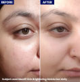Jenpharm - Maxdif Brightening Moisturizer – Niacinamide & Vitamin C Face Cream for Glowing Skin | Dark Spot & Uneven Skin Tone Treatment | Hydrating Skin Brightening Cream. 