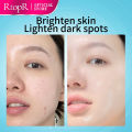 RtopR Vitamin C Serum Snail Brightening Fade Dark Spot Lightening Serum Brightening Skin Care Fine Lines Anti-aging Whiten Moisturize Less Breakouts Facial Serum Skincare for Men and Women 20ml. 