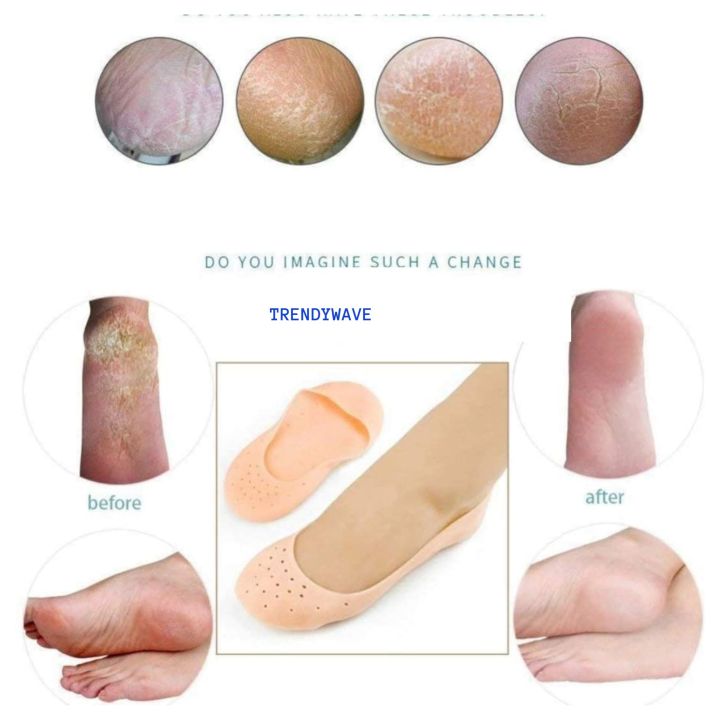 The%20Visionary%20Anti%20crack%20heel%20socks%20Silicone%20Full%20Length%20Anti%20Crack%20Foot%20Protector%20Moisturizing%20Socks%20for%20Foot-Care%20and%20Heel%20Cracks%20for%20Men%20and%20Women%20(Free%20Size)%20(Pack%20Of%201%20Silicon%20Socks)%20-%20Image%203
