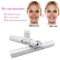 Kd-7910 Acne Laser Pen Machine Blu-Ray Acne Pen Toxin Removal Treatment-White. 