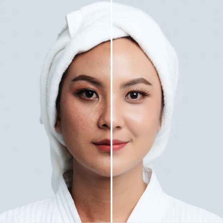 Easy%20Fresh%20Face%20Wash%20(60ml)%20-%20Image%206