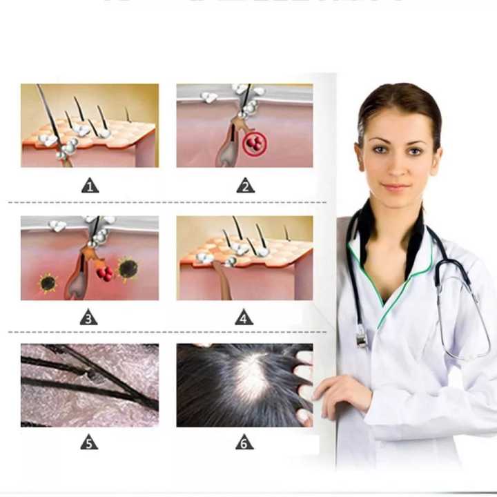 7%20Days%2030%20ML%20Fast%20Hair%20Growth%20and%20Hair%20Care%20Serum%20Oil%20Prevent%20Deep%20Repair%20Damaged%20Hair%20Conditioner%20-%20Image%209