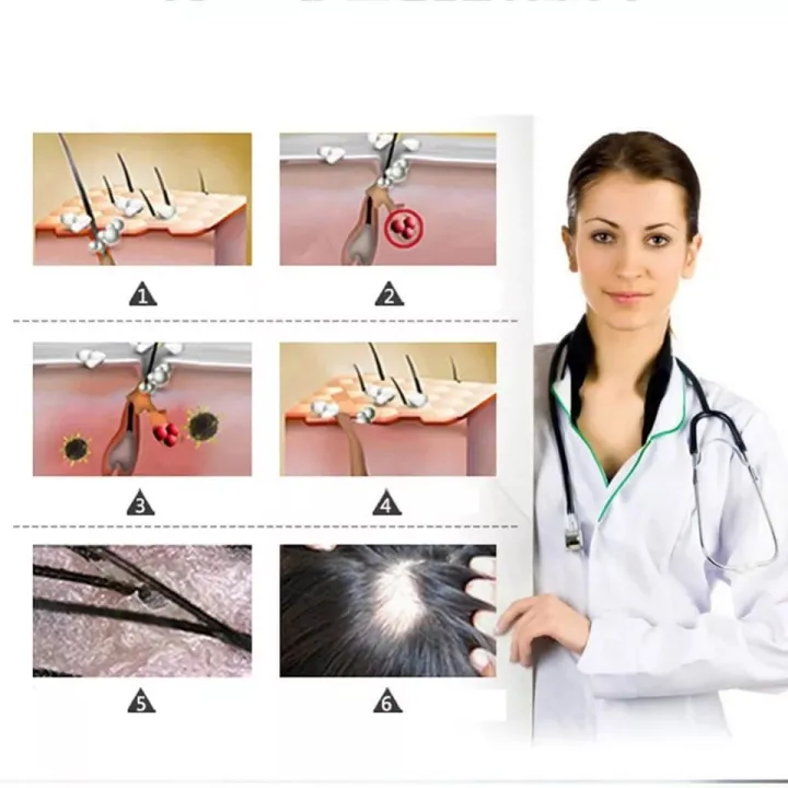 7%20Days%2030%20ML%20Fast%20Hair%20Growth%20and%20Hair%20Care%20Serum%20Oil%20Prevent%20Deep%20Repair%20Damaged%20Hair%20Conditioner%20-%20Image%209