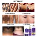 AILKE Premium Skin Lightening Cream - Dark Spot Corrector for Uneven Skin Tone - Face, Body, Underarm, Knees, Elbows,. 