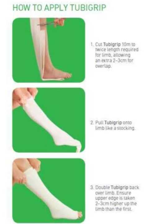 TUBY%20GRIP%20FOR%20%20KNEE%20AND%20THIGH%20ELASTICATID%20STOCKINETTE%20BP%20.%20AN%20ELASTICATED%20TUBULER%20SUPPORT%20BANDAGE%201%20METER%20-%20Image%206