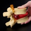 Lumbar Vertebrae Model Anatomical Spine Lumbar Disc Herniation Anatomy Teaching Tool Lumbar Vertebrae Model. 