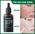 FORT Salicylic Acid Serum – Anti-Acne Face Serum & Dark Spot Correcting Serum for Glowing Skin | Acne Skin Care Products 30ml. 