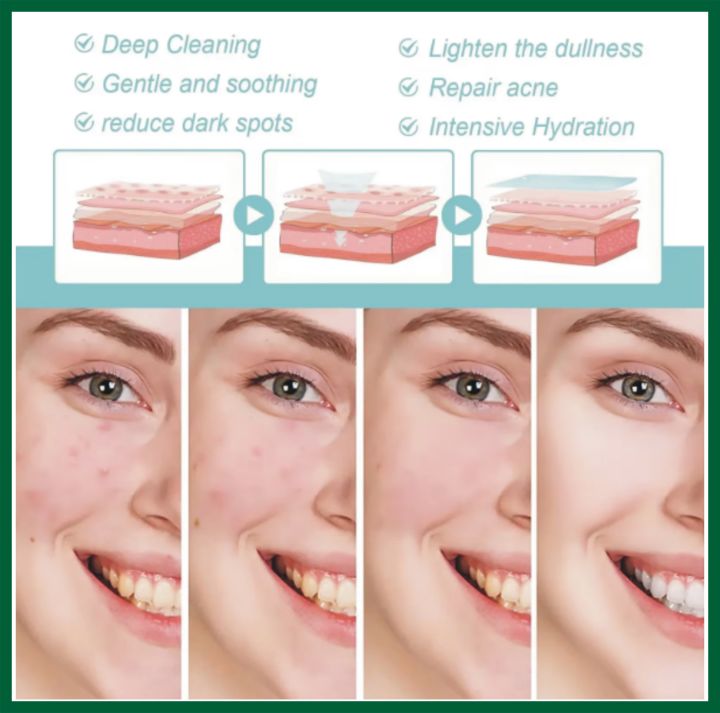 FORT%20FORT%20Acne%20Clear%20Face%20Wash%20-%20Salicylic%20Acid%20Cleanser%20for%20Oil%20Control%20&%20Anti-Acne%20%7C%20Acne%20skin%20care%20products%20Reduces%20Blackheads%20&%20Whiteheads%20100ml%20-%20Image%204