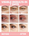 UPTOWN LA  Dark Circles  Under Eye Gel For Brighter and Shiner Eyes. 
