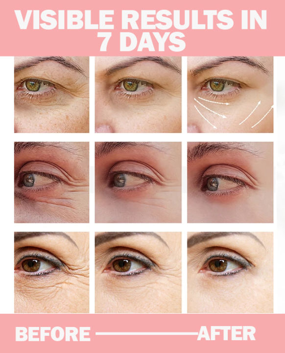 UPTOWN%20LA%20%20Dark%20Circles%20%20Under%20Eye%20Gel%20For%20Brighter%20and%20Shiner%20Eyes%20-%20Image%205