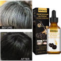 New Repair Damage Anti-Hair Sercum Gray Hair Care Serum Ebony Hair Nourishing Hair Loss Men And Women Fast Lasting Beauty Health Feeoi Freeio. 