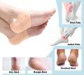 Silicone Gel Heel Pad Socks For Pain Relief And Anti Crack Heel 1 Pair Heel Cups Heel Guards Heel Protectors Heel Sleeves For Relieve Heel Pads Cushion Heel Pain, Heal Dry Cracked Heels, Achilles Tendinitis, For Men & Women. 