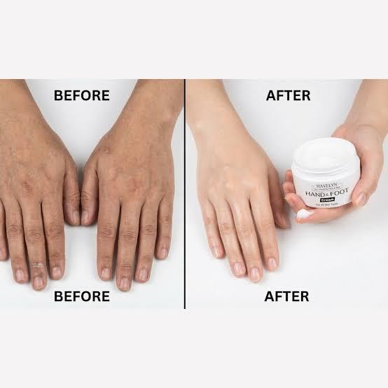 Hands%20and%20Foot%20Cream%20for%20Deep%20Moisturizing,%20Repairing%20Dry,%20Rough%20and%20Cracked%20Skin,%20Enriched%20with%20Natural%20Oils%20and%20Vitamins%20to%20Nourish,%20Soften%20and%20Protect%20Hands%20and%20Feet,%20Leaving%20Them%20Smooth,%20Healthy,%20Fresh%20and%20Silky%20All%20Day%20Long%20Use%20Daily%20Care!!%20-%20Image%206