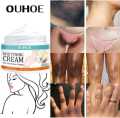 Aveessence Sensitive Area & Underarm Whitening Cream – 7 Days Result. 