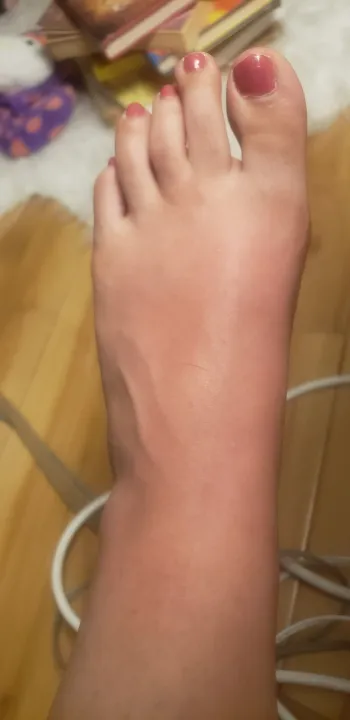 Smooth%20and%20Painless%20Facial%20Hair%20Removal/Exfoliator%20-%20Pack%20of%206%20for%20Unwanted%20By%20Sheer%20Skin%20-%20Beauty%20Tools%20/%20Hair%20Removal%20Accessories%20-%20Image%202