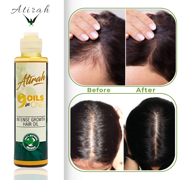 ATIRAH 100% Organic 9-in-1 Hair Growth Oil | Anti-Dandruff & Hair Fall Solution for Men & Women | Best Hair Oil for Long, Strong & Healthy Hair (120ml)