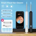 Smart Visual Ear Wax Cleaning Kit with Camera HD – Wireless Ear Cleaner Endoscope – Rechargeable Earwax Removal Tool with Soft Silicone Tips - Rechargeable HD Ear Camera with Mobile Display. 