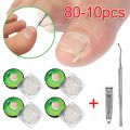 80-10pcs Ingrown Toenail Correction Tool Ingrown Toe Nail Treatment Elastic Patch Sticker Straightening Clip Brace Pedicure Tool. 