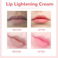 EELHOE Lip Moisturizing Brightening Cream Lightening Pigmentation Dark Smoke Lips Remove Dead Skin Treatment Lips Freshing Cream. 