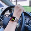 Milanese Loop for apple watch band 44mm ultra-2 49mm 45mm 40mm 41mm 42-44 mm starlight bracelet iwatch series 9 8 7 6 SE 5 4 3 2 Girlymax Store. 