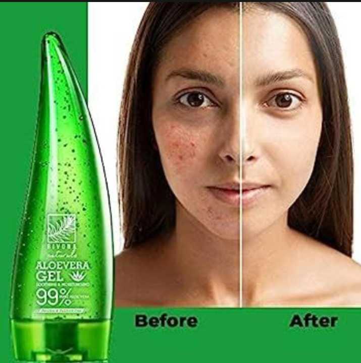 Pure%20Bliss%2099%25%20Aloe%20Vera%20Soothing%20Gel%20for%20Skin%20-%20Natural%20Cooling%20and%20Hydration%20-%20Image%202