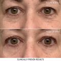 Eye Cream Instant Anti Aging Remove Dark Circles Wrinkle Removal Bags Puffiness Fade Eye Fine Line Skin Face Tighten Korean Care. 