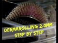2mm Titanium Microneedle Derma Roller Dermaroller Micro Needle Skin 2mm. 